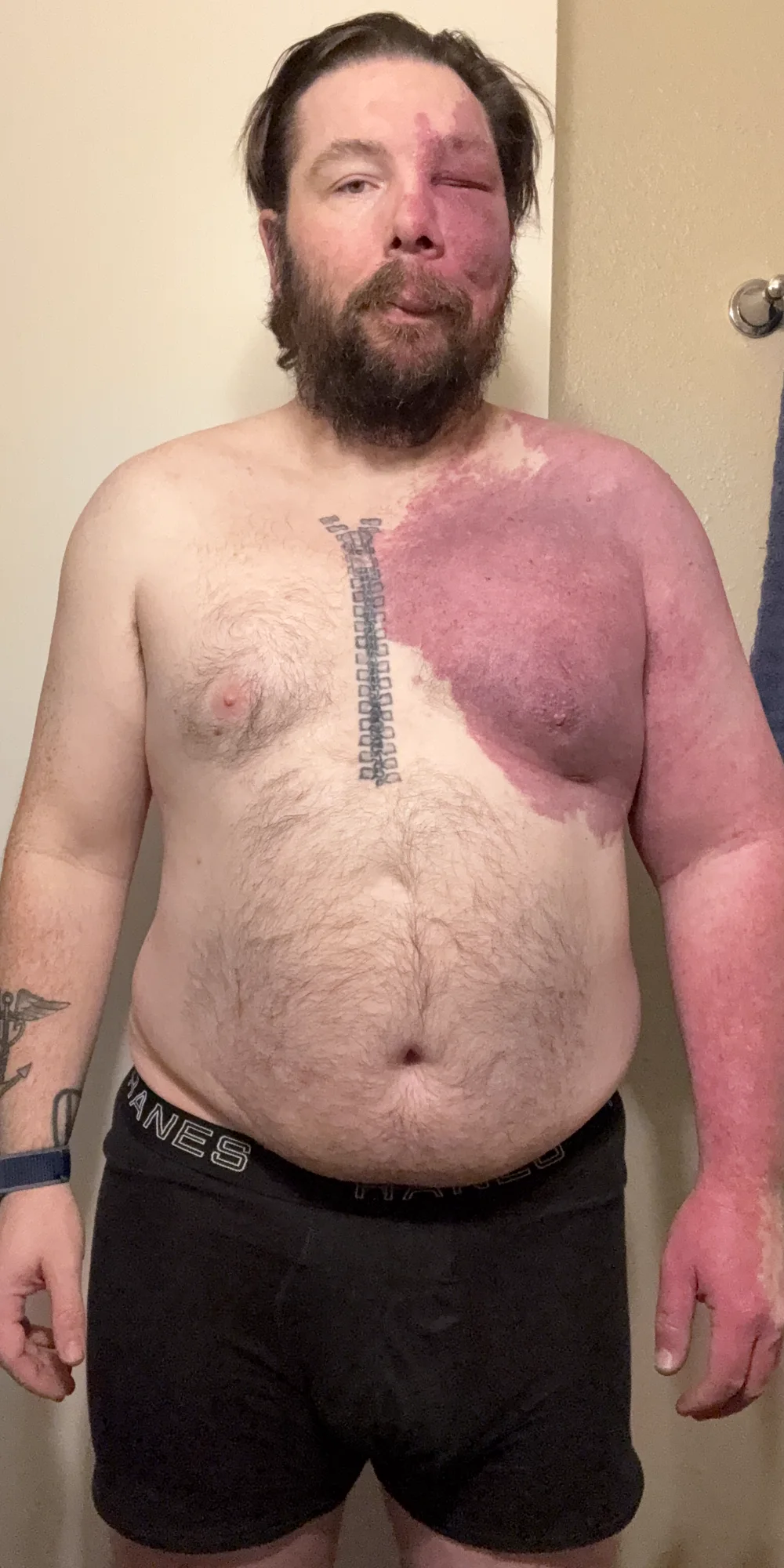 James standing indoors in black shorts in the before photo.